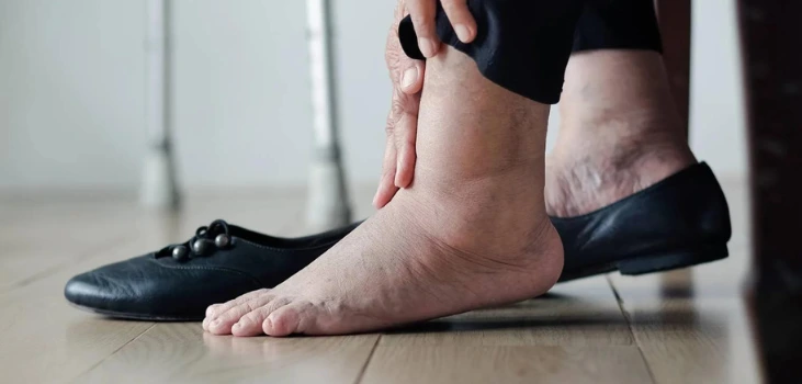 woman holding het foot in pain